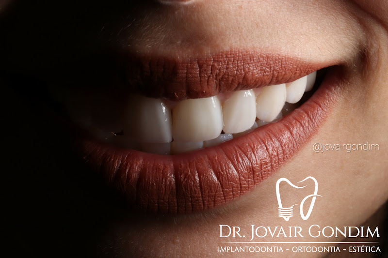 Foto 3 de Dr Jovair Gondim