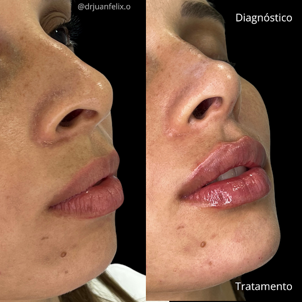 Foto 2 de Dr Juan Felix - Harmonização Facial Salvador