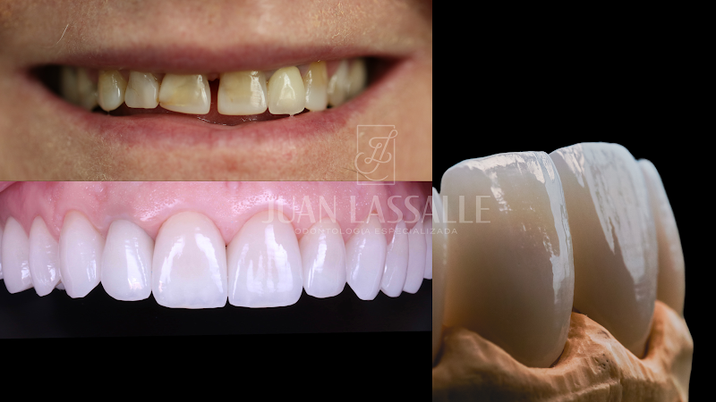 Foto 3 de Dr. Juan Lassalle