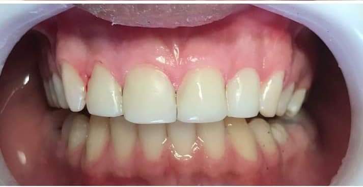 Foto 3 de Dr Juarez Ferreira - Dentista diretor clínico.