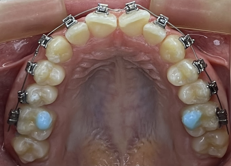 Foto 2 de Drª Juliana Pessoa- Cirurgiã-Dentista