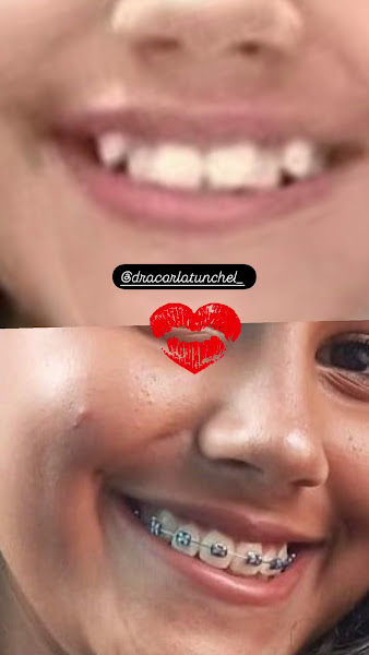 Foto 3 de Dr. Júnior Costa | Dentista no Bom Retiro