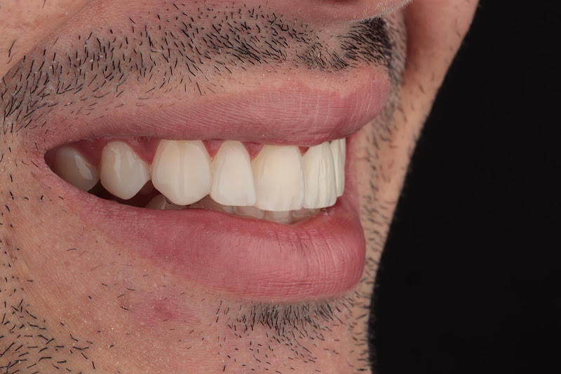Foto 2 de Dr. Kássio Ramon - Dentista em Arraial D'Ajuda