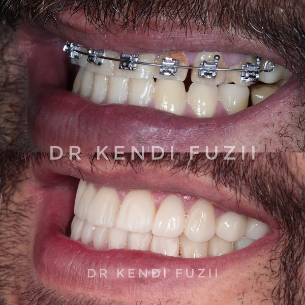 Foto 2 de Dr Kendi Fuzii - Odontologia Estética