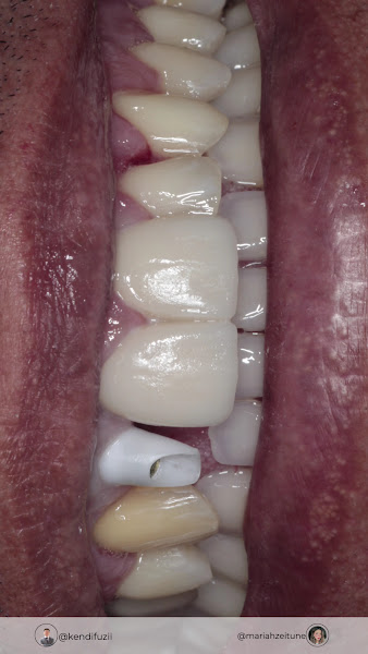 Foto 3 de Dr Kendi Fuzii - Odontologia Estética