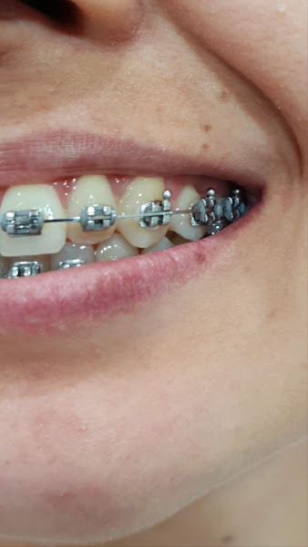 Foto 3 de Dr. Kleginaldo Araújo - Consultório Odontológico - Odontologia