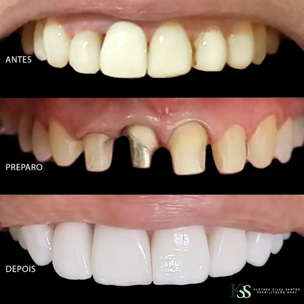 Foto 2 de Dr. Kleyber Santos