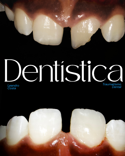 Foto 3 de DR. Leandro Costa - Facetas Estéticas