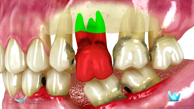 Foto 3 de Dr Leandro Dias, Dentista: ATM, Bruxismo, Implantes, DTM