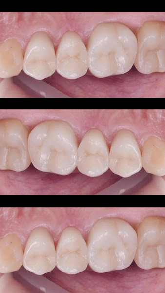 Foto 4 de Dr Leandro Dias, Dentista: ATM, Bruxismo, Implantes, DTM