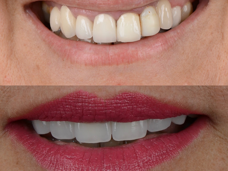 Foto 3 de Dr. Leandro Gianichini | Dental Center
