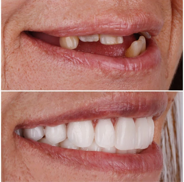 Foto 5 de Dr. Leandro Mattar - Odontologia Especializada