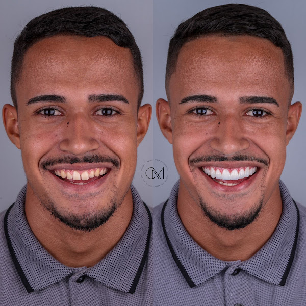 Foto 2 de Dr. Leandro Mello - Cirurgião Dentista