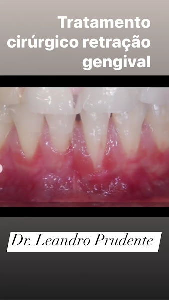 Foto 2 de Dr. Leandro Prudente de Freitas