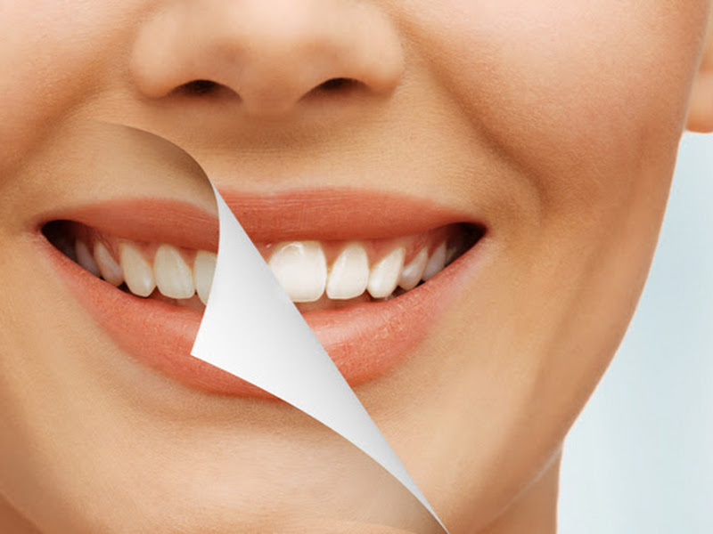 Foto de Dr. Léo Grinstein (Odontologia Estética de Alto Padrão) Centro Rio