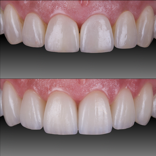 Foto 3 de Dr. Leonardo Andrade | Odontologia e estética facial
