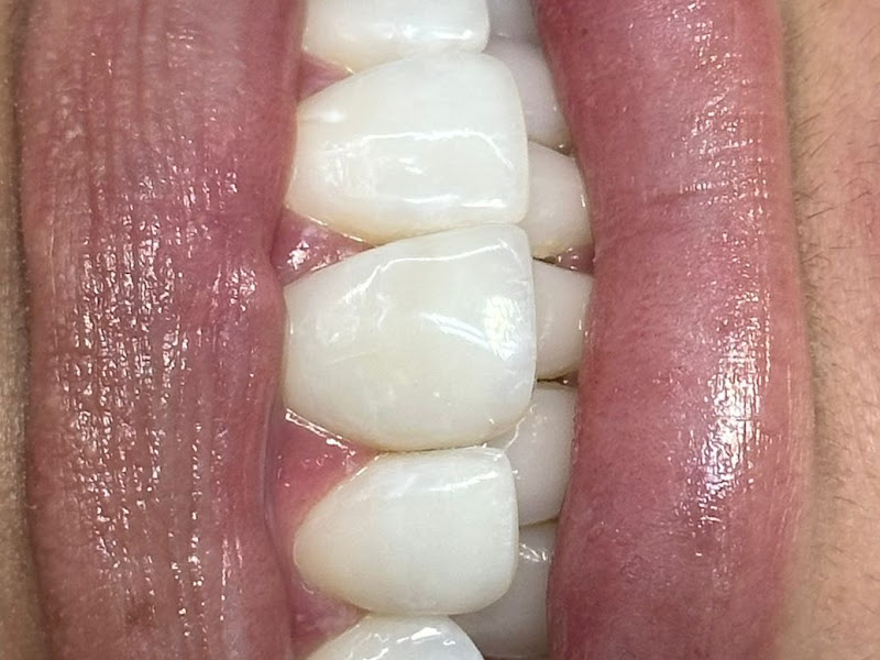 Foto 3 de Dr. Leonardo Blanco - Dentista