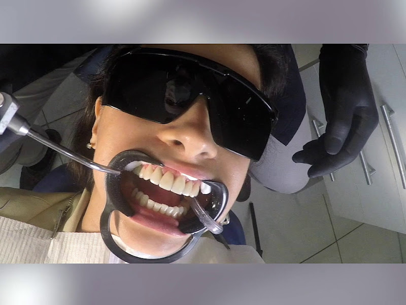 Foto 5 de Dr. Leonardo Blanco - Dentista