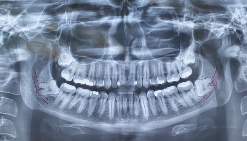 Foto 3 de Dr. Leonardo Boechat - Cirurgião Bucomaxilofacial