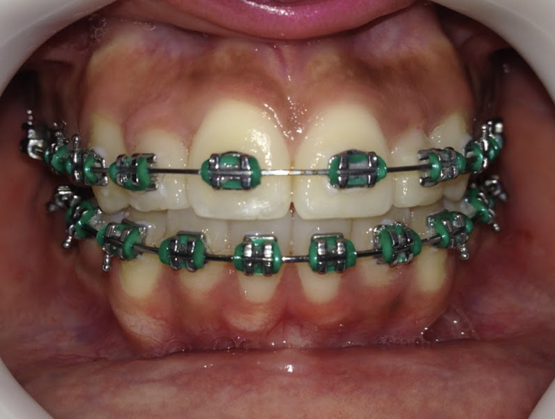 Foto 2 de Dr. Leonardo Ferreira Ortodontia & Reabilitação Oral