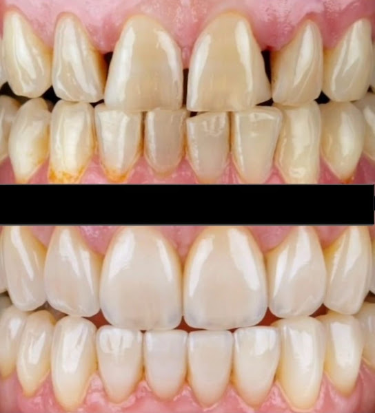 Foto 2 de Dr Leonardo Machado/ Dentista em Blumenau