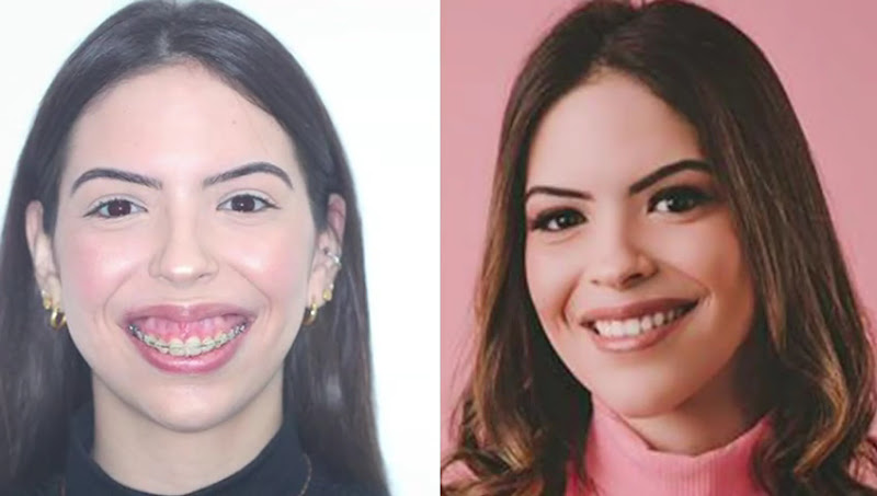 Foto 3 de Dr. Leonardo Mendes Campos - Cirurgião Bucomaxilofacial e implantodontista em João Pessoa