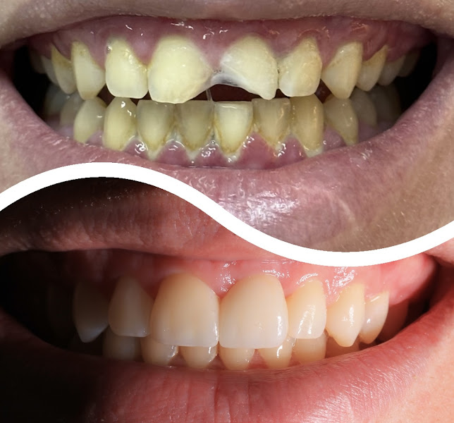 Foto de Dr. Leonardo Moll - Implantes Dentários e Reabilitação Oral