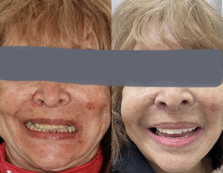 Foto 2 de Dr. Leonardo Moll - Implantes Dentários e Reabilitação Oral