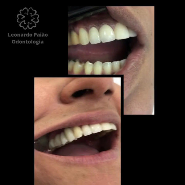 Foto 3 de Dr. Leonardo Paião | Implantes e Estética em Pirituba