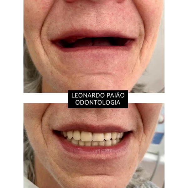 Foto 4 de Dr. Leonardo Paião | Implantes e Estética em Pirituba
