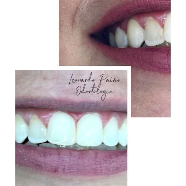 Foto 5 de Dr. Leonardo Paião | Implantes e Estética em Pirituba