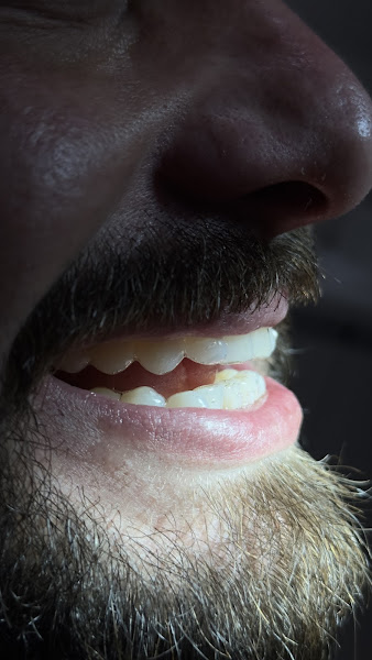 Foto 2 de Dr. Leonardo Rosseto | Dentista em Chapecó