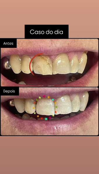 Foto 2 de Dr Leonardo Silva - Dentista