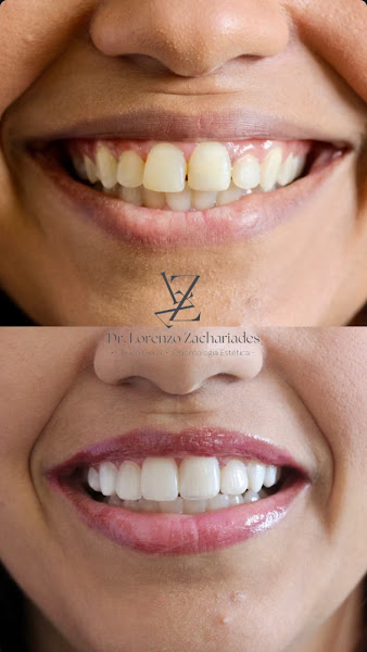 Foto 3 de Dr. Lorenzo Zachariades | Harmonização Facial