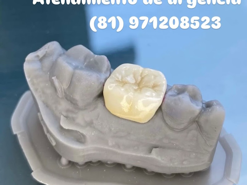 Foto de Dr Luan Bezerra dentista 24 Horas em Boa viagem