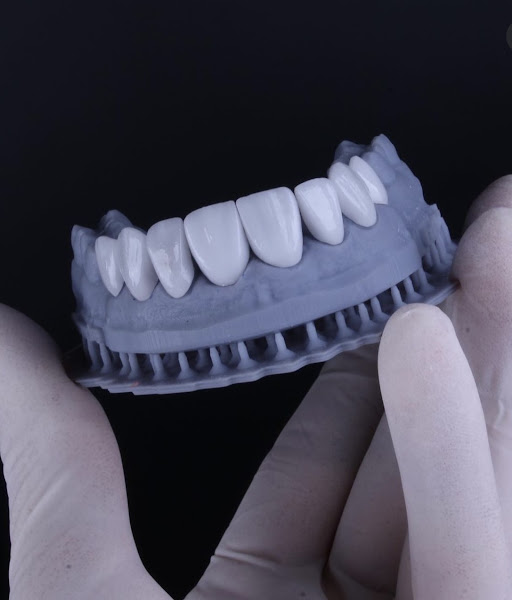 Foto 3 de Dr. Lucas Barbosa - Lente de Contato Dental