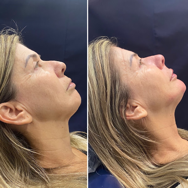 Foto 2 de Dr. Lucas Lemos - Harmonização Orofacial e Clínico Geral - Odontologia