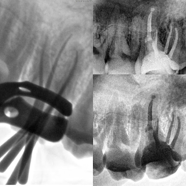 Foto 3 de Dr. Lucas Morais - Dentista