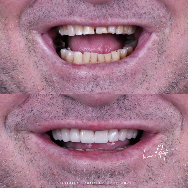 Foto 2 de Dr Lucas Pequito Cirurgião - Dentista