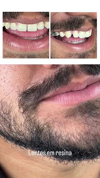 Foto 3 de Dr Lucas Pequito Cirurgião - Dentista
