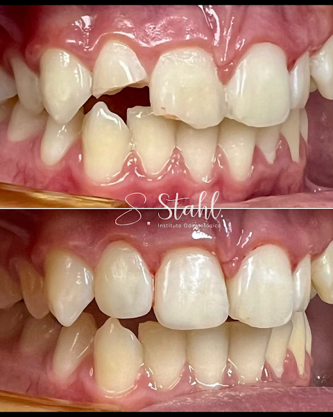 Foto 3 de Dr. Lucas Stahl | Dentista Centro - Limeira