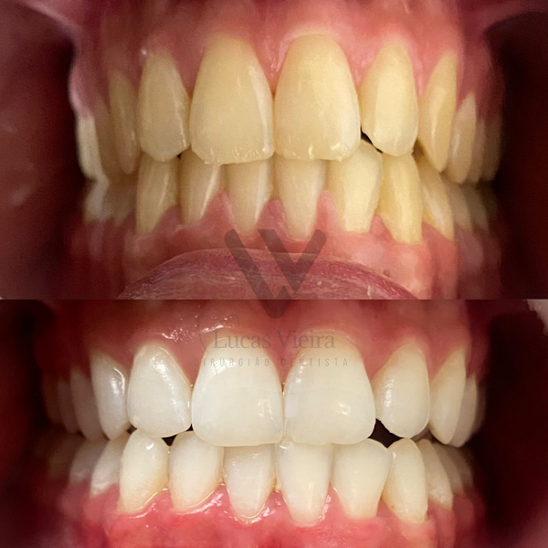 Foto de Dr. Lucas Vieira e Dr. Lucas Magalhães - Odontologia