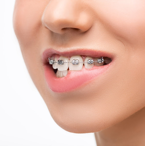 Foto 3 de Dr. Luciano Copat - Cirurgião Dentista