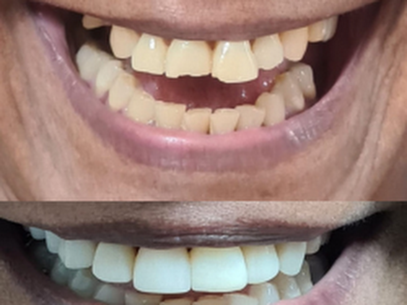 Foto 9 de Dr. Luciano Dantas - DENTISTA SALVADOR