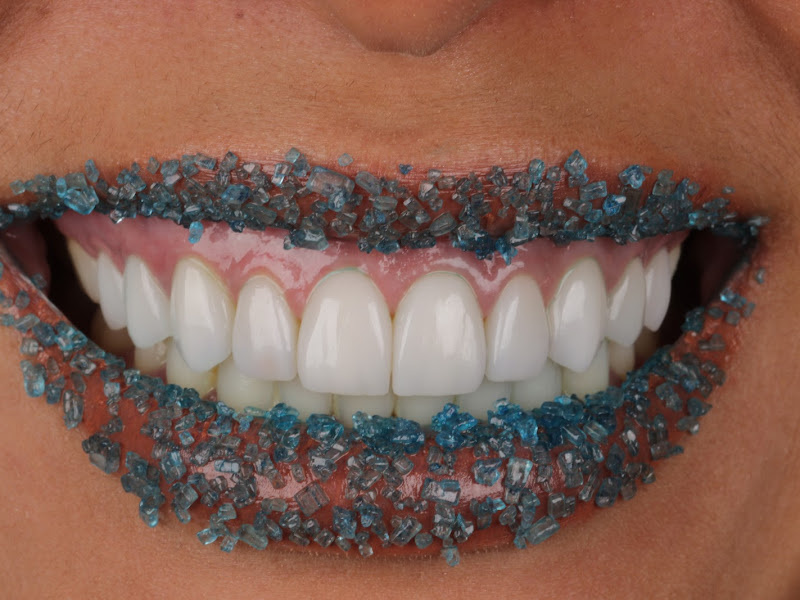 Foto de Dr Luis Bertolo - Lentes de Contato Dental e Facetas Bauru