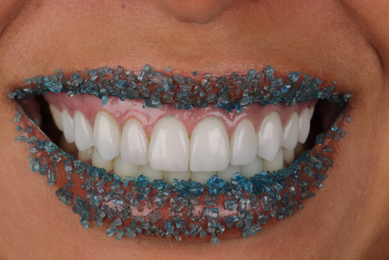 Foto 2 de Dr Luis Bertolo - Lentes de Contato Dental e Facetas Bauru