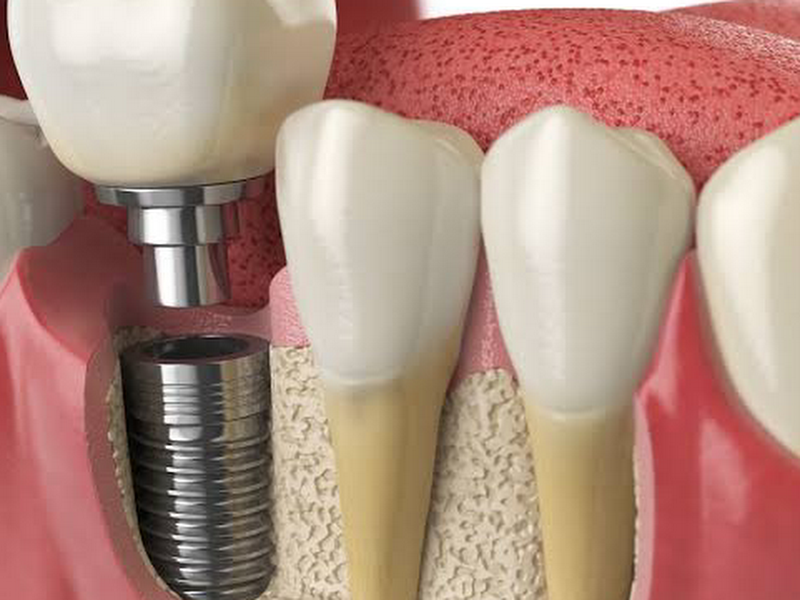 Foto 2 de Dr. Luis Filipe Deip | Cirurgião Buco-Maxilo-Facial Manaus