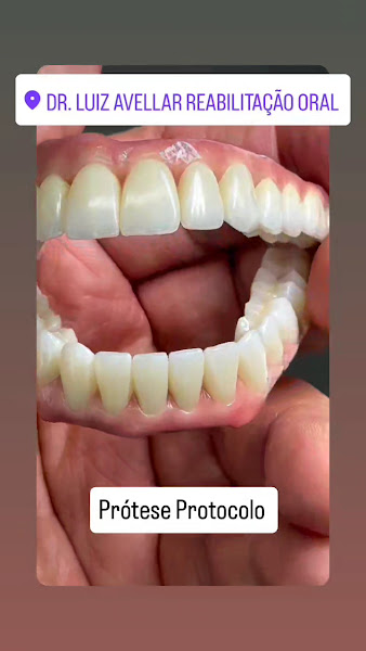 Foto 4 de Dr. Luiz Avellar | Dentista em Sobradinho