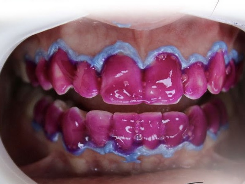 Foto de Dr Luiz Carlos Marques -INVISALIGN
