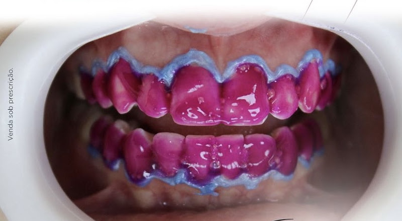 Foto 2 de Dr Luiz Carlos Marques -INVISALIGN